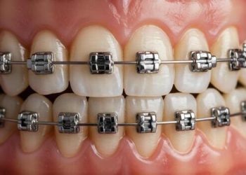 Othordontics